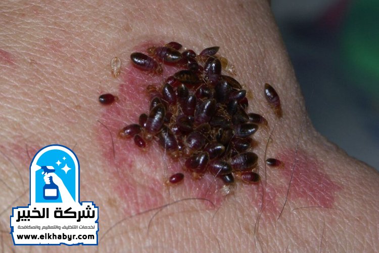 شركة مكافحة بق الفراش في ابوظبي